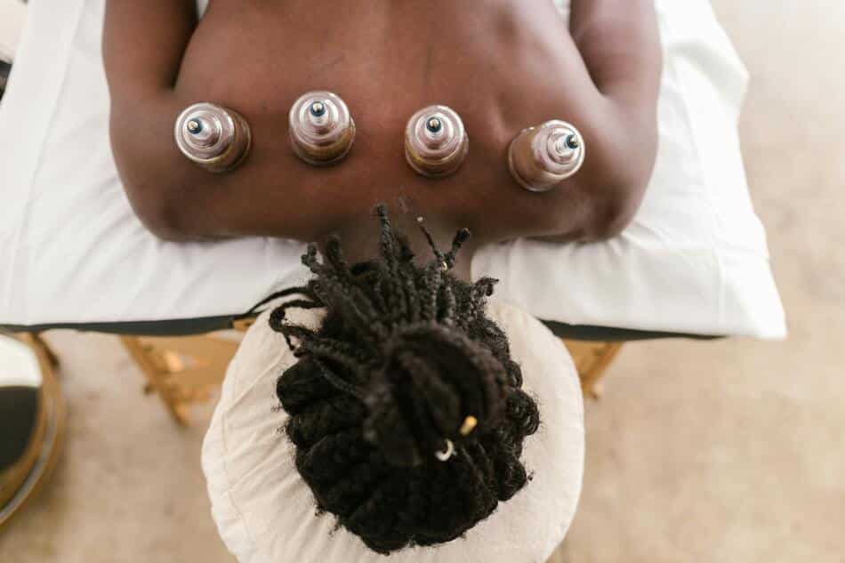 A person getting cupping treatment to experience the benefits of cupping.