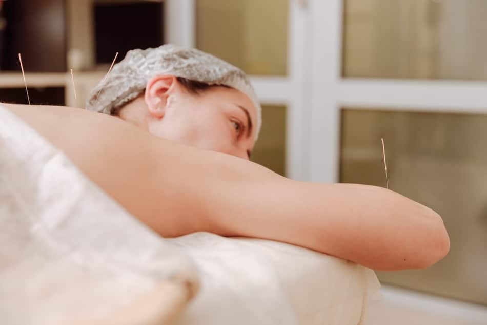 A woman preparing to get acupuncture for women's health treatments.