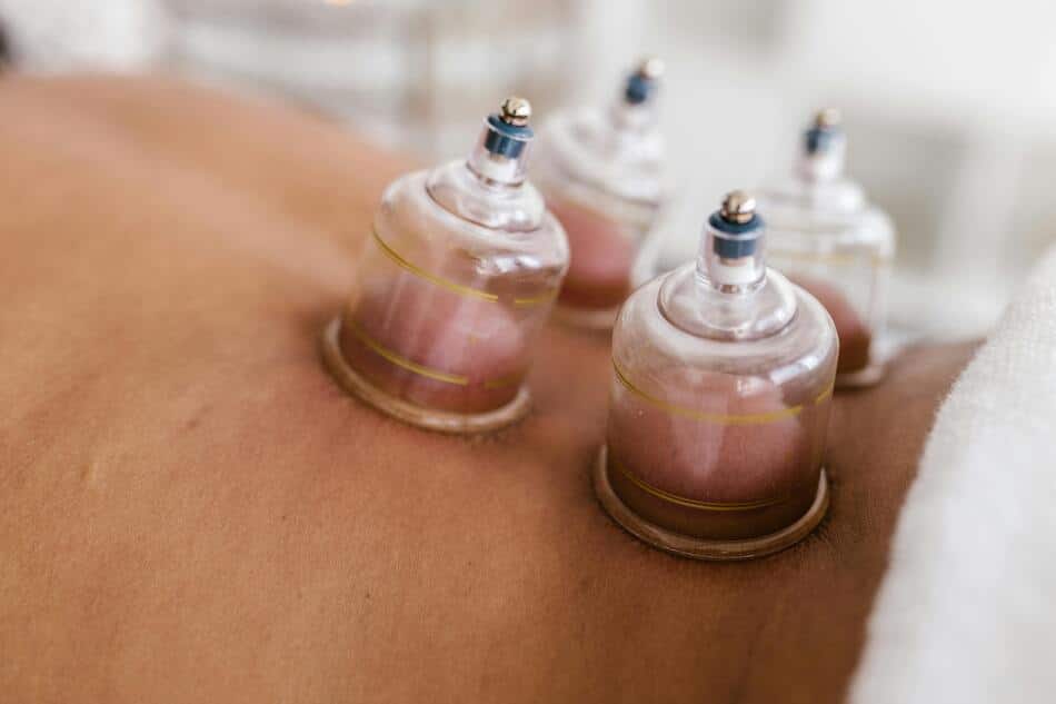 A close-up shot of lower back cupping therapy.