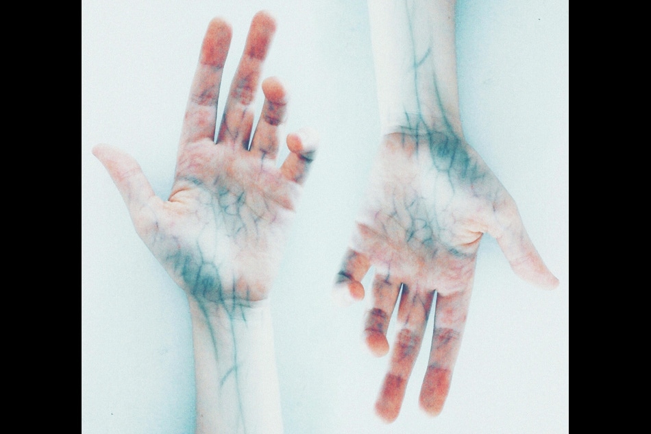 A photograph of hands with blue veins.
